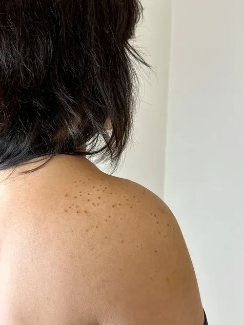 Freckle tattoo work by Maggie