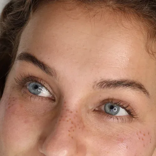 Open blue-grey eyes with freckles