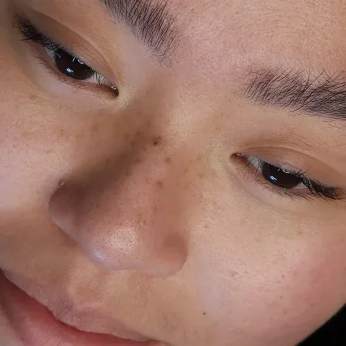 Nose and cheek freckle close-up