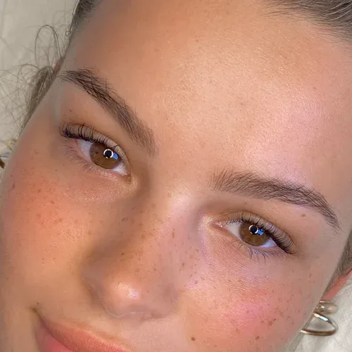 Healed freckles and brows, blonde